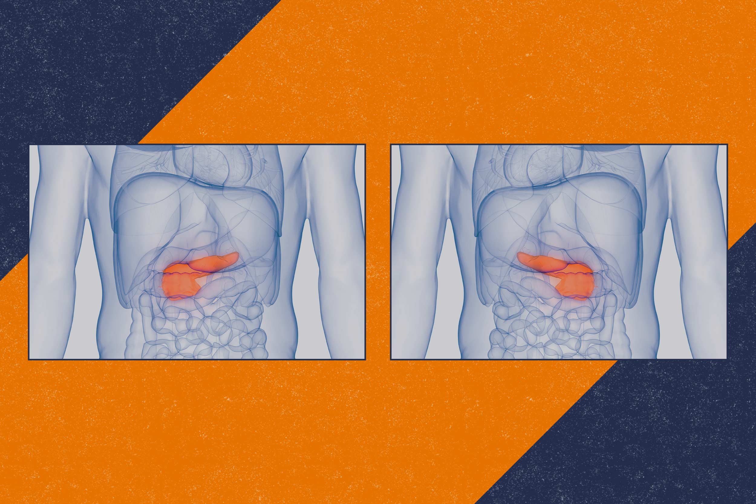 UVA artificial pancreas system using digital twin technology for diabetes control