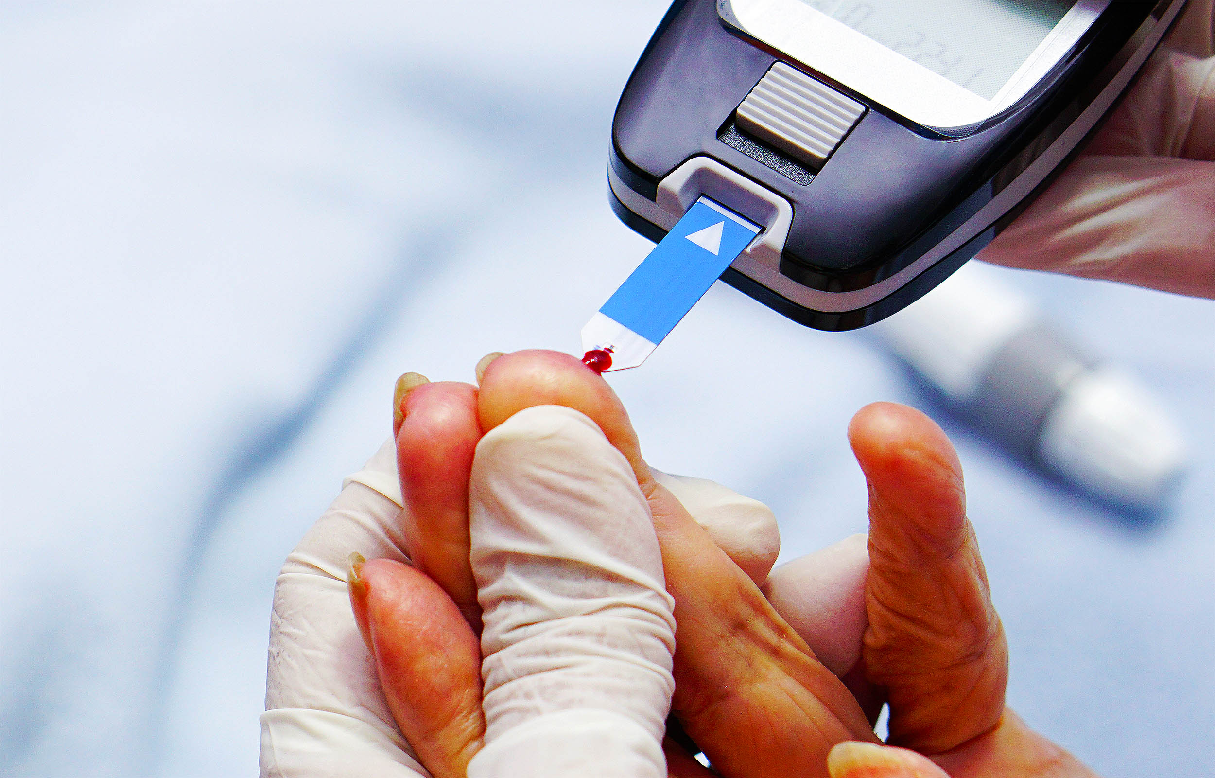 Blood test highlighting new Type 5 diabetes