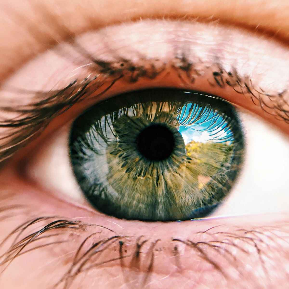 Close-up of an eye highlighting nvAMD risk in metformin users