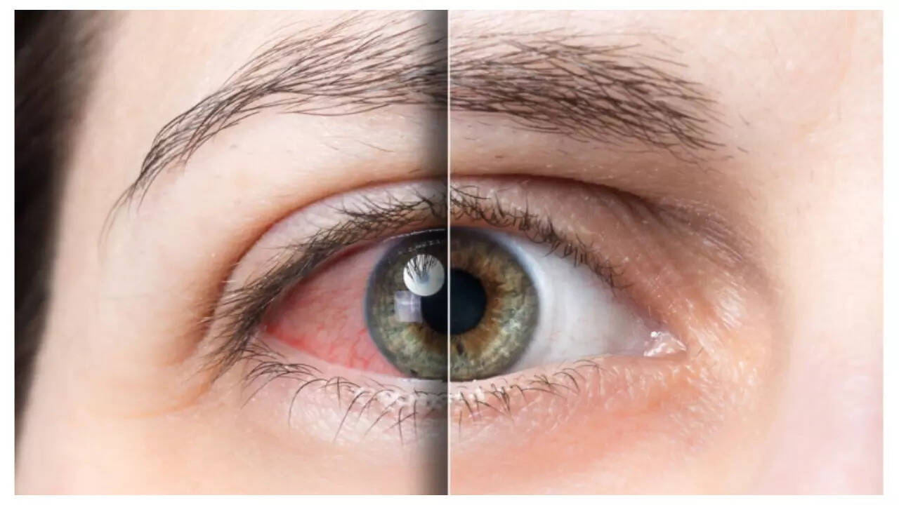 Unexpected Heroes and Game-Changing Diabetes Discoveries from Today 2 Diabetic eye complications retinopathy macular edema