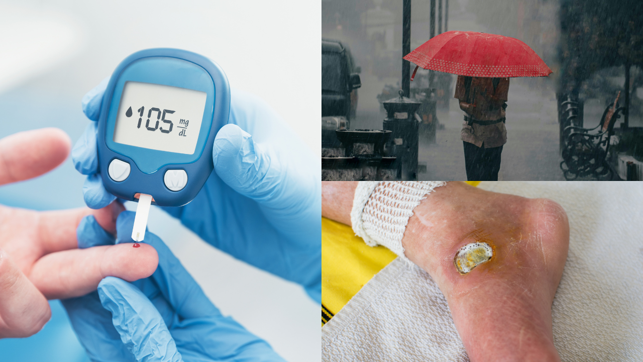 Diabetic patient keeping feet dry during monsoon to prevent infections