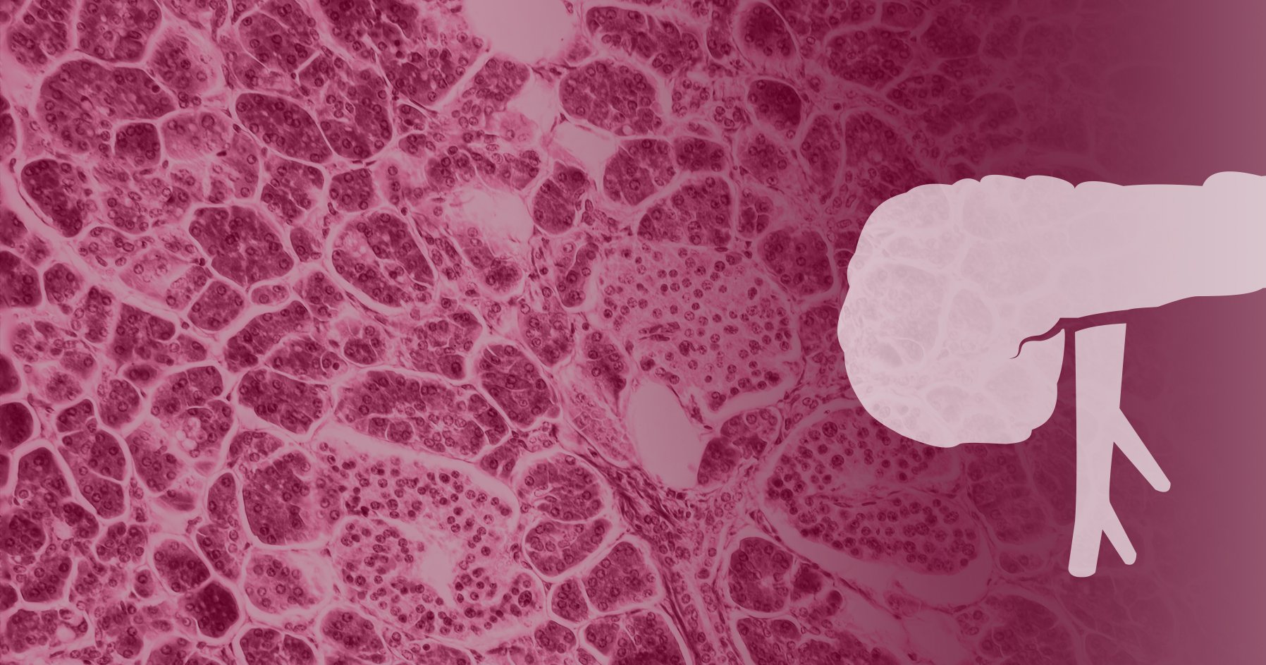 Preconception care for women with diabetes