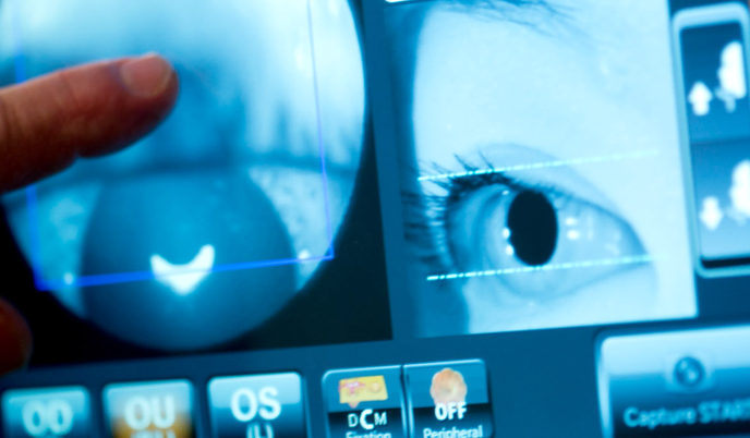Teleophthalmology screening for diabetic retinopathy using retinal camera