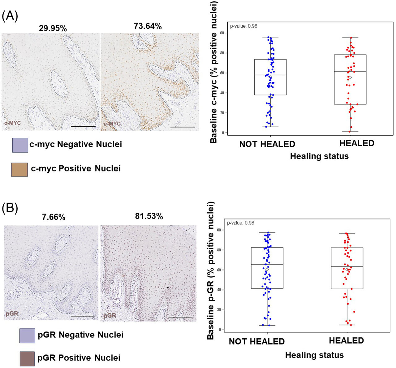 Graph showing variations in cell counts in diabetic foot ulcer samples