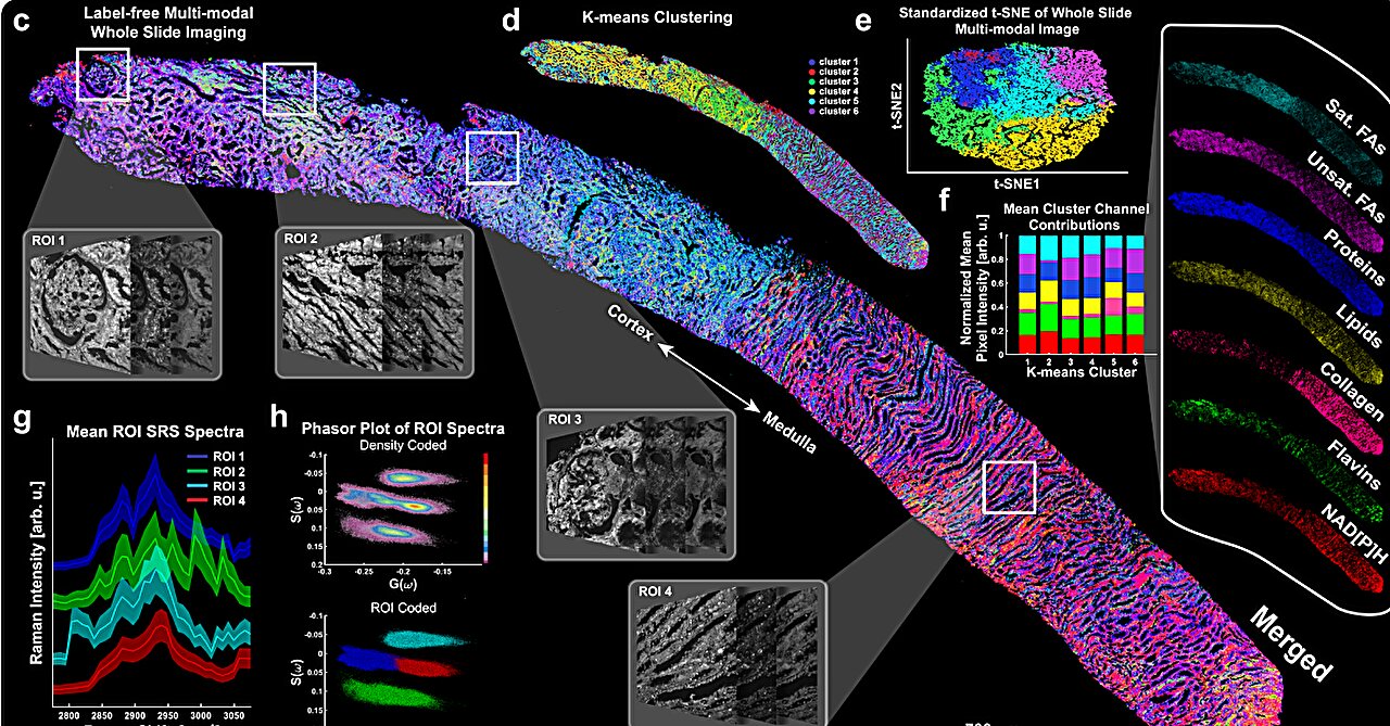 Optical imaging diabetic kidney disease detection