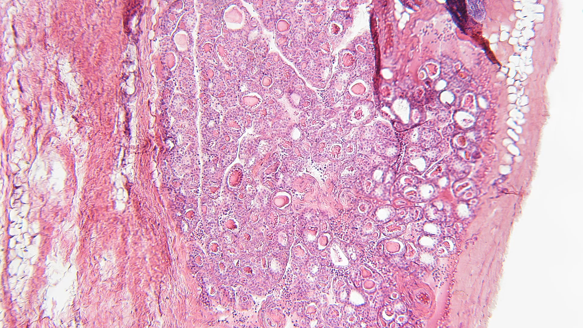 Advanced biomarkers for diabetic retinopathy