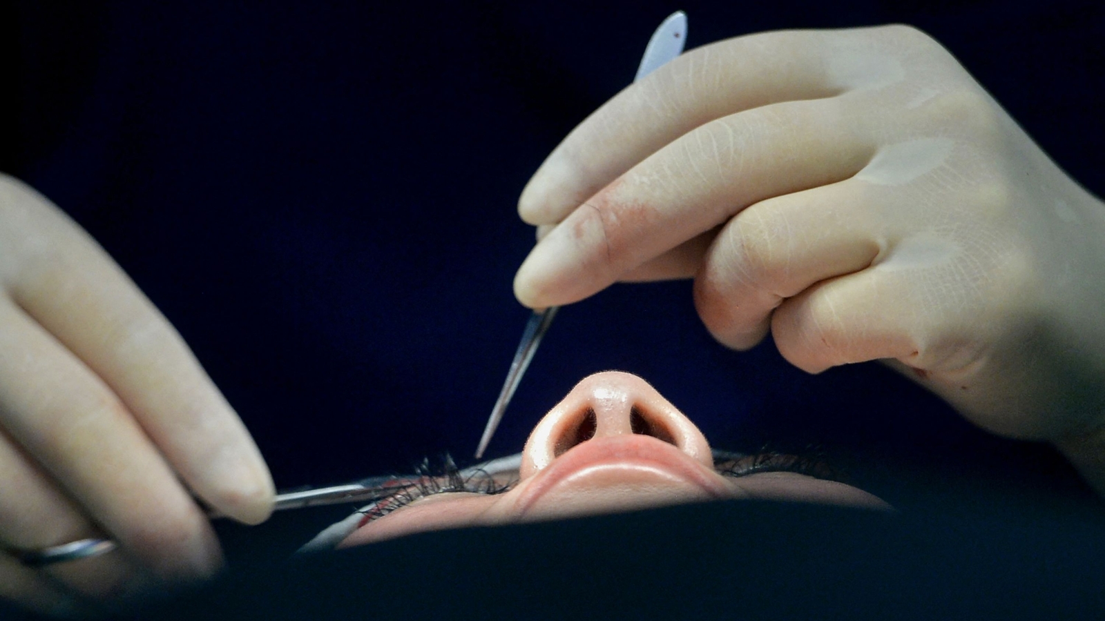 Doctor advising diabetic father on cataract prevention