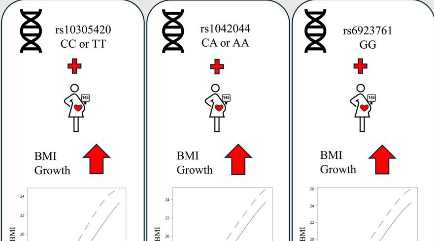 Unlocking Diabetes Clues: 8 New Study Insights on Sugar, Genetics and Treatment 2 Genetic variant raises obesity risk in children exposed to gestational diabetes