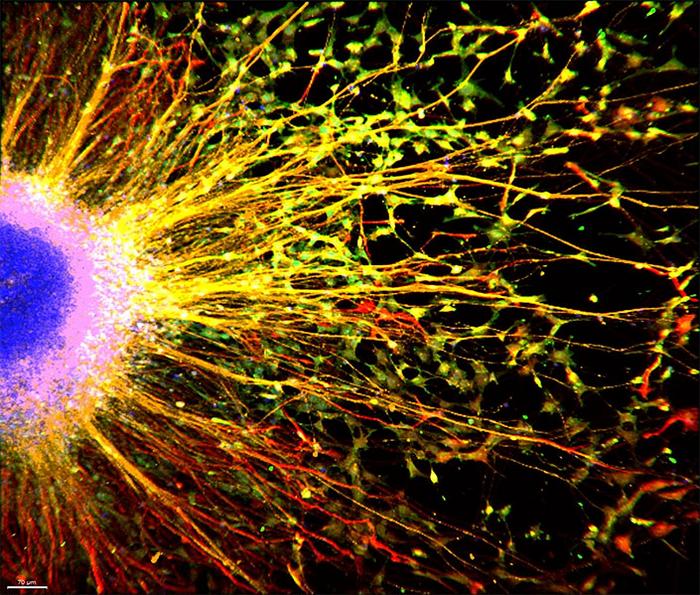 9 Critical Diabetes Updates You Can’t Afford to Miss Today 5 Illustration of AgRP neurons affecting blood sugar