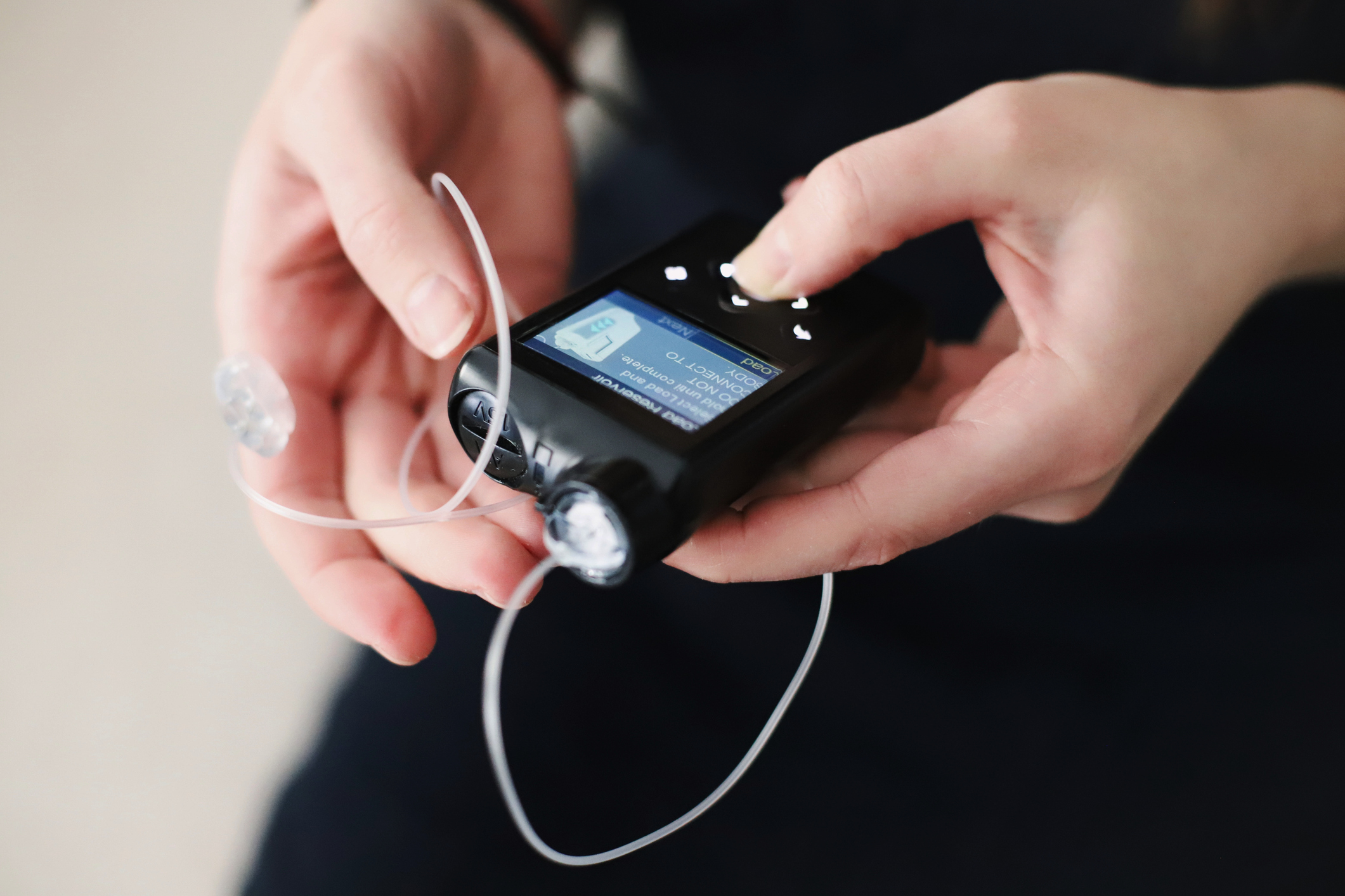 Automated insulin pump improving glucose levels in type 2 diabetes