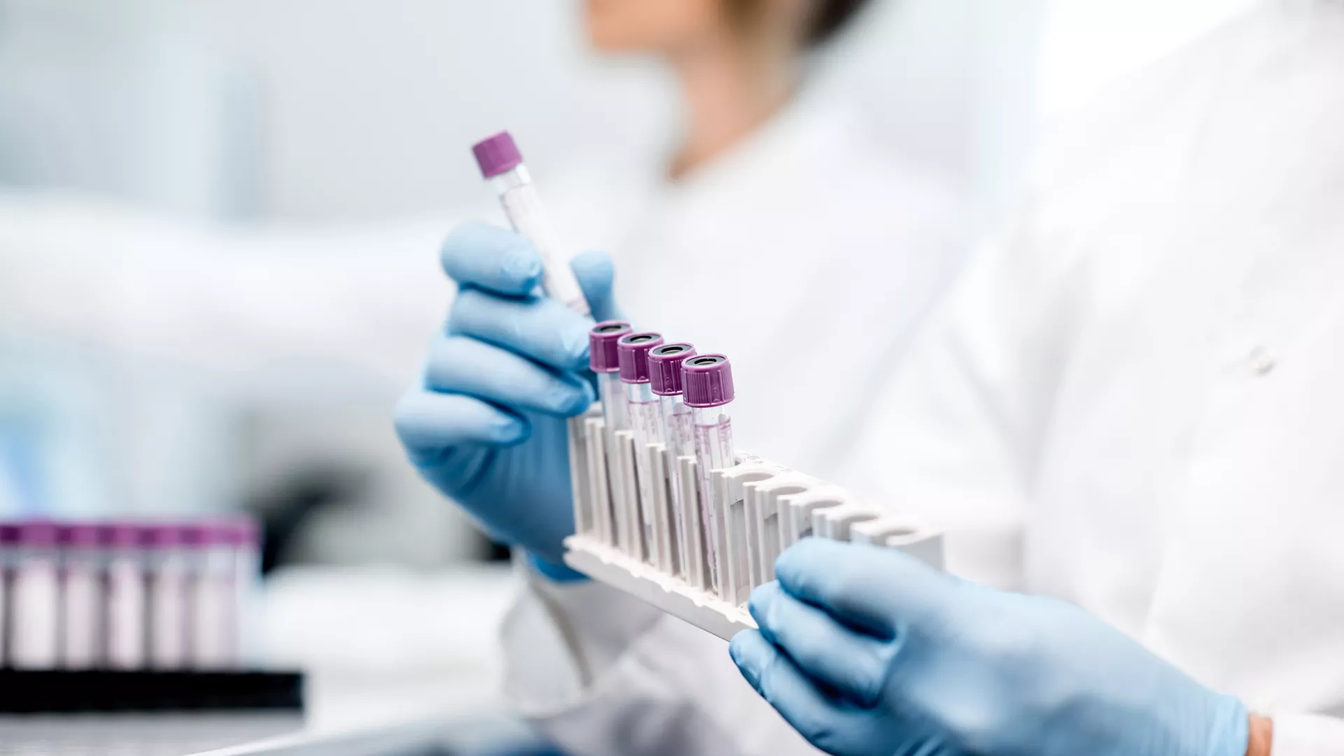 Lab technician analyzing clinical indicators to predict diabetes risk