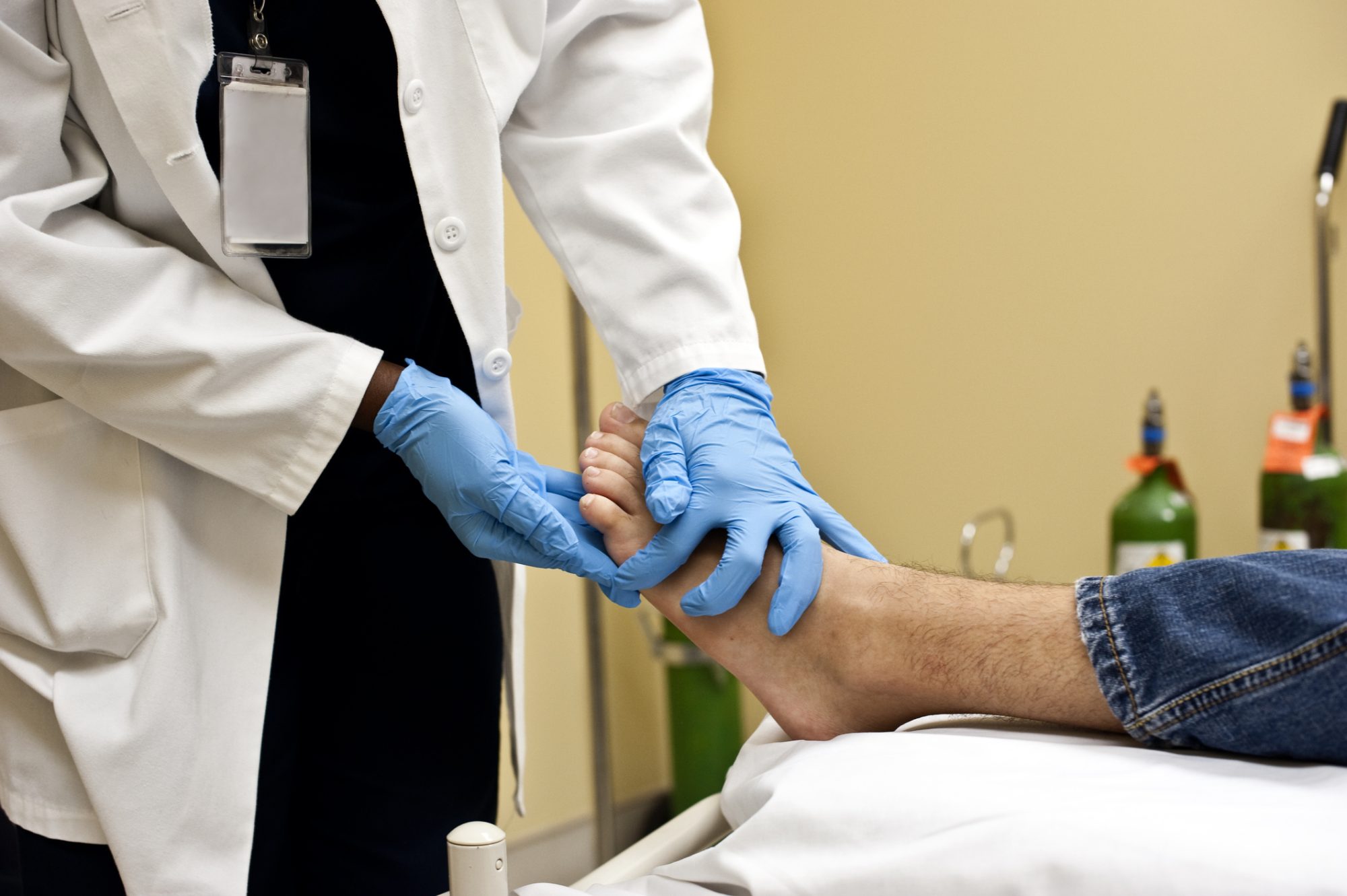 Healthcare professional treating diabetic foot ulcer with proper care