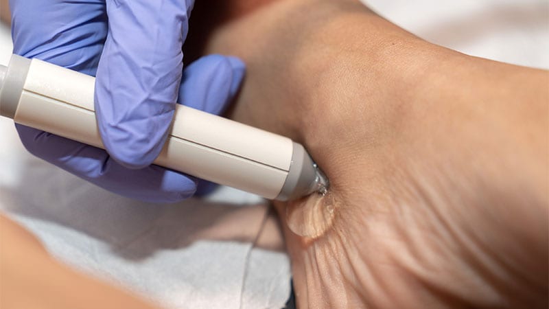 Patient receiving foot exam highlighting semaglutide’s limb protection benefits